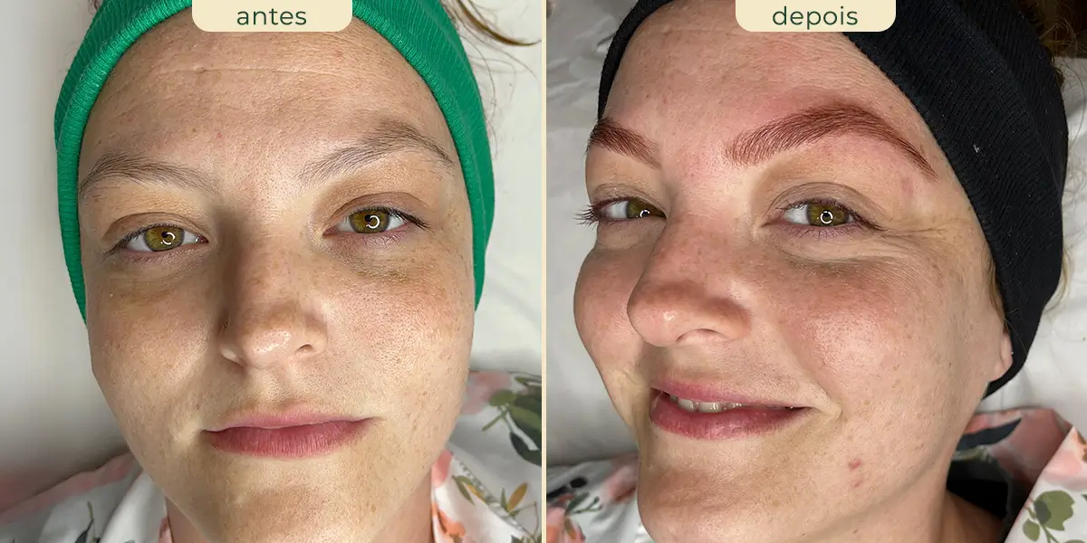 foto comparativa antes e depois do procedimento coloração de fios de sobrancelhas feito em mulher ruiva aparentemente com 30 anos.